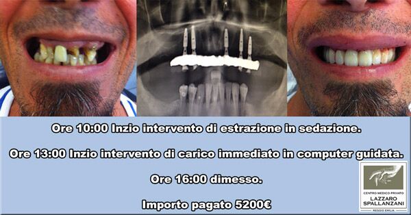 impianti dentali 24 ore Lazzaro Spallanzani Reggio Emilia